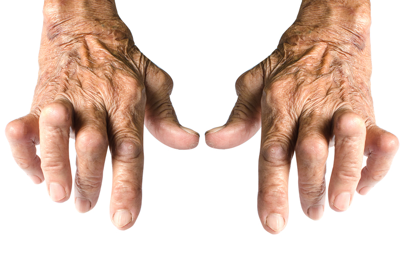 Chondroitin Sulfate and Its Rheumatoid Arthritis Benefits